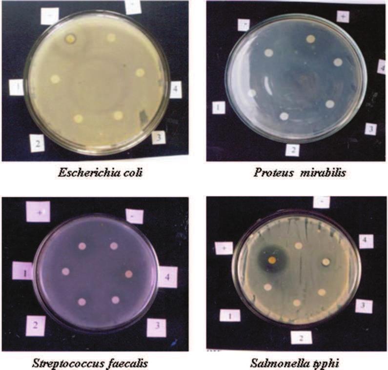 Plate 4 Antibacterial activity of Nostoc calcicola against clinical pathogens Escherichia coli Proteus mirabilis Streptococcus faecalis Salmonella typhi + Positive control -