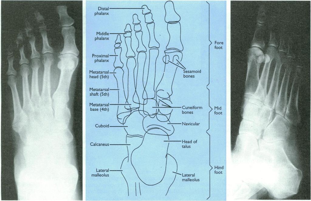 l ja ) $% _2) < j> ~~~~~~~~~~~~~~~~~foot ABC of Emergency Radiology THE FOOT D A Nicholson, D O'Keeffe, P A Driscoll Accurate clinical assessment of injuries to the foot will avoid unnecessary