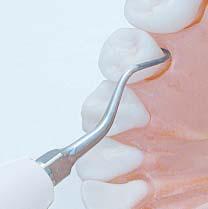 4 3D Z217-403 10 To remove subgingival stains, the tip may be used as per manual curettes.