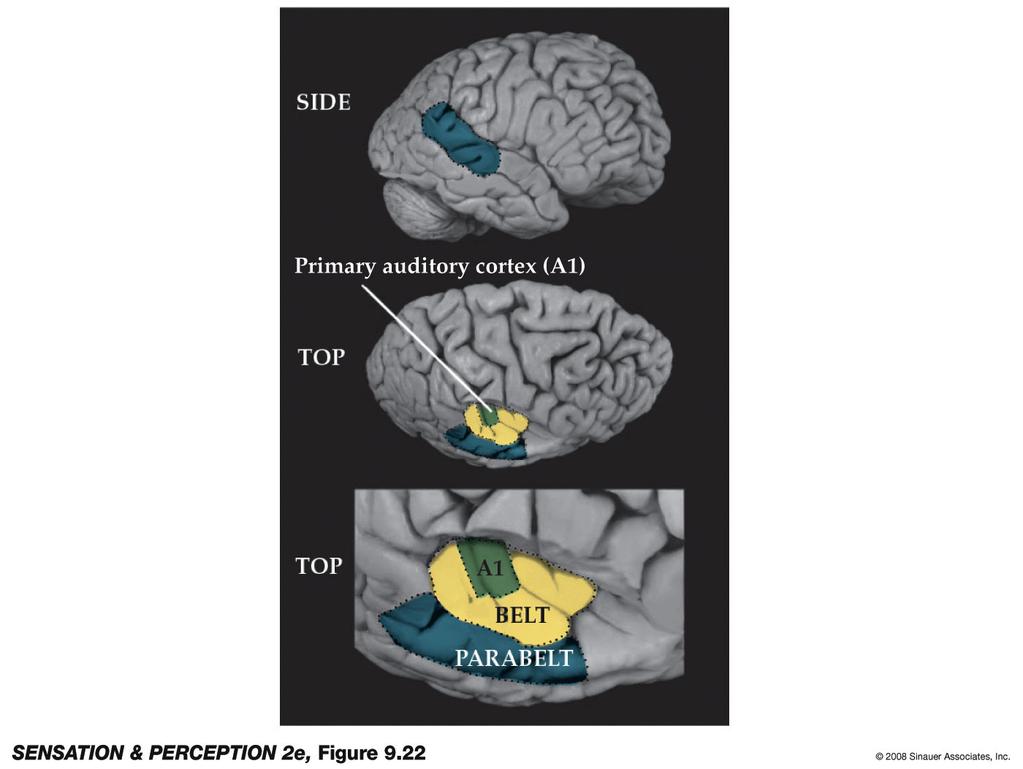 Primary auditory cortex (A1): First cortical area for processing audition (in temporal lobe) Belt
