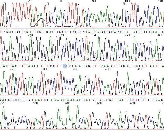 Directed Single Gene Analysis Mutation Detection Traditional Testing for specific sequence changes Family specific Common mutations Sanger Sequencing