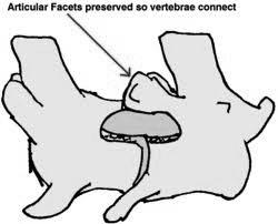 articular facets Must know WHICH side