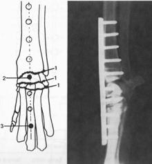 hyperextension injuries Plating the anterior surface of the carpus l Partial Carpal Arthrodesis Pinning/Plating the midcarpal & carpometacarpal joints NOTE: