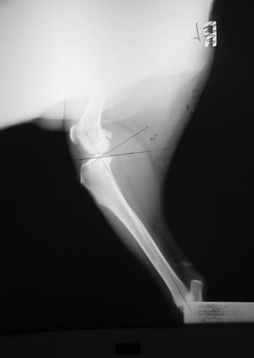 l Tibial Plateau Levelling Osteotomy Created by Barclay Slocum, 1993 Licensed technique / Instrumentation / Implants