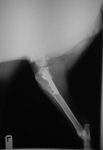 Excessive slope = wear & tear of CCL Sx = correct slope with or without medial meniscal release l Lateral preoperative