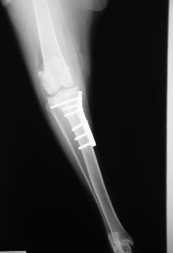 There is mild osteoarthritic change The Tibial plateau angle (TPA) is 25 degrees l Tibial plateau levelling osteotomy