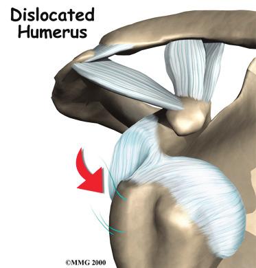 The joint capsule has a considerable amount of slack, loose tissue, so that the shoulder is unrestricted as it moves through its large range of motion.