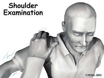 In some cases, shoulder instability can happen without a previous dislocation. People who do repeated shoulder motions may gradually stretch out the joint capsule.
