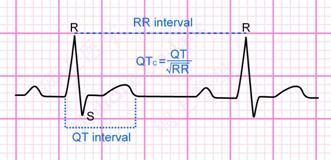 Electrocardiogram Should be obtained if a normal ECG is not available from the previous 90 days.