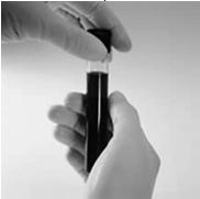 OTHER TESTING METHODOLOGIES Blood Analysis Summary Advantages Can Detect a Wide Range of Drugs Low likelihood of adulteration or substitution Disadvantages Invasive