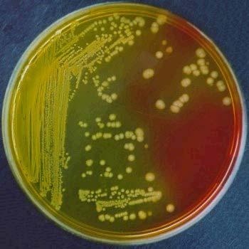 Brilliant-green in the medium inhibits accompanying micro-organisms. The picture shows an uninoculated plate.