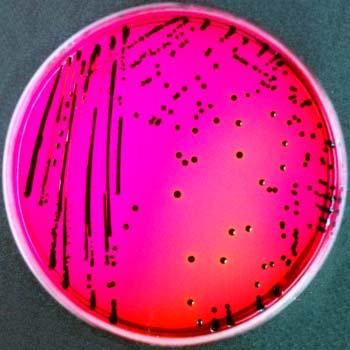 Xylose lysine desoxycholate (XLD) agar This medium is used for the isolation of shigellae and salmonellae from foods and clinical specimens.