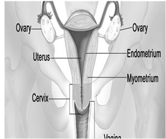 DIAGNOSTIC/STAGING PROCEDURES Endometrium Endometrial biopsy Fractional dilation and curettage (D&C) Hysteroscopy Imaging CT MRI CA 125 TREATMENT-CERVIX IA1 Fertility sparing Cone biopsy with margins