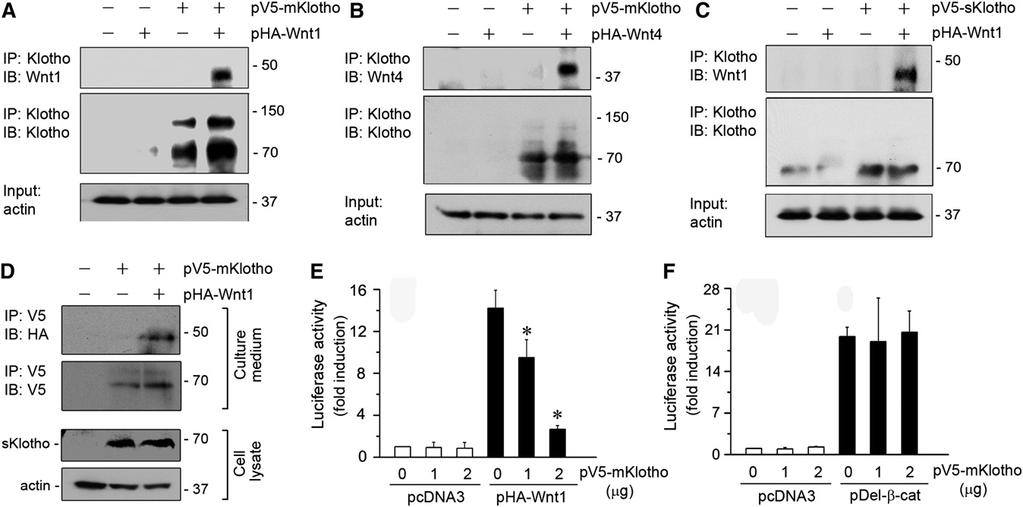 Figure 3. Klotho binds to Wnt and blocks Wnt-mediated gene transcription. (A) Co-immunoprecipitation demonstrates that Klotho binds to Wnt1 in tubular epithelial cells.