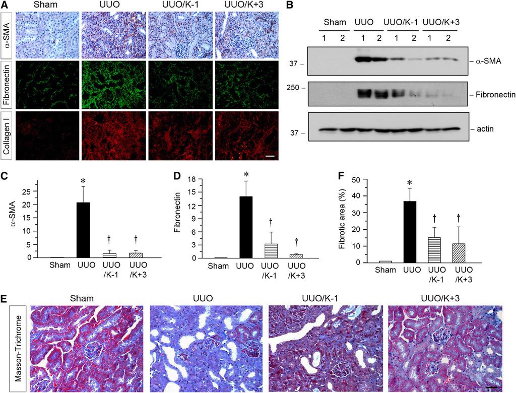 Figure 7. Ectopic expression of secreted Klotho in vivo attenuates renal fibrosis in obstructive nephropathy.
