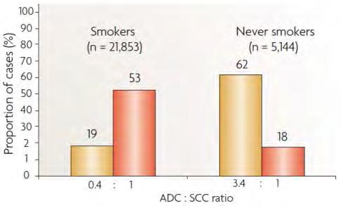 Lung cancer in life-long non-smokers* Smokers (*<100 lifetime cigarettes) Never-Smokers Time