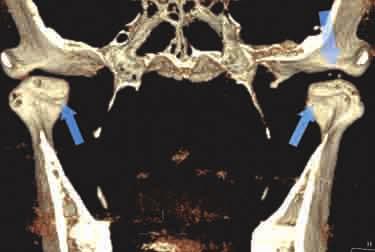 Significant findings such as calcification of arteries, airway masses, florid paranasal sinus disease and lucencies in the vertebral column could lead to a catastrophic health event for the patient.