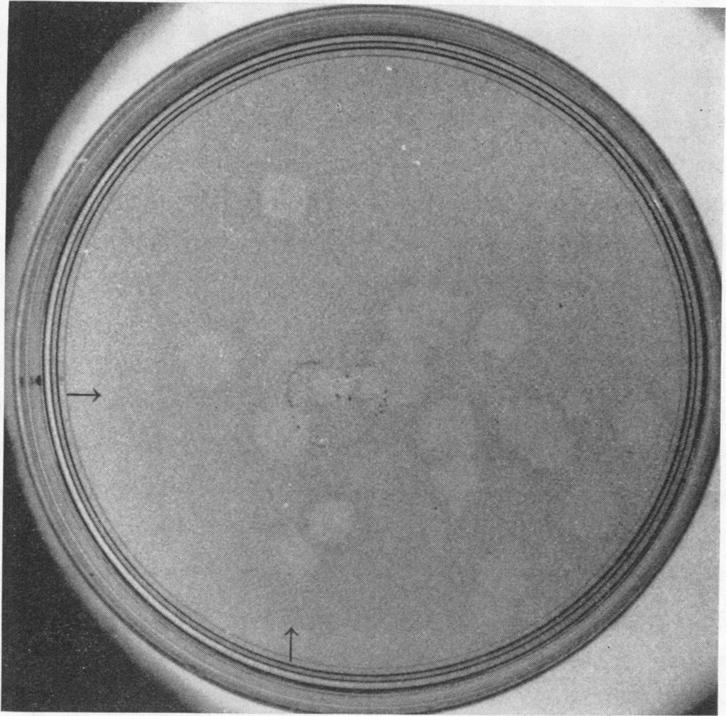 VOL. 4, 1971 MUTANTS OF LCM VIRUS 283 FIG. 2. Turbid plaques from a plaque pickedfrom the 10-4 plate of MB6L1I, treated tt,e same way as in Fig. 1. Although most of the progeny gave turbid plaques, there were a few lytic plaques preseint.
