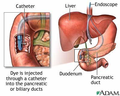 The Endoscope is positioned in the duodenum