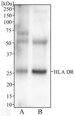 Images Western Blot: HLA-DR Antibody (L243) [NB100-77855] - Western blot analysis of human spleen (A) and human tonsil (B) tissue using HLA- DR antibody at