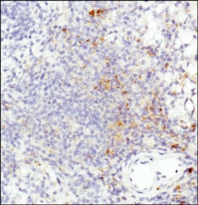 1 Updated 8/18/2016 Immunohistochemistry-Paraffin: HLA-DR Antibody (L243) [NB100-77855] - IHC staining of HLA-DR in human spleen using DAB with hematoxylin