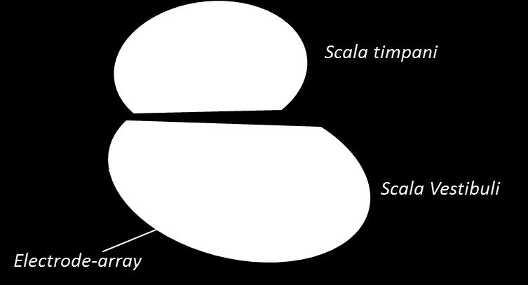 Figure 1: Schematics of cochlear cross-section extracted from a temporal bone, with fit of elliptic model on the scala timpani showing width W and height H.