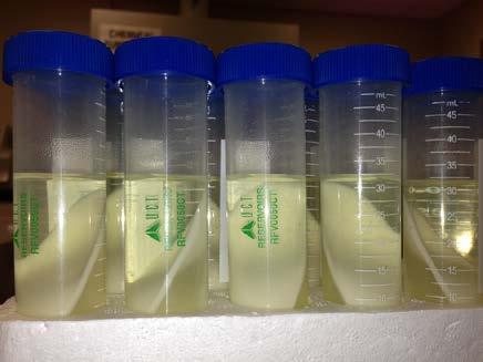 Procedure: 1. QuEChERS extraction a) Transfer 15 ml of whole milk into 5-mL centrifuge tube (RFV5CT).