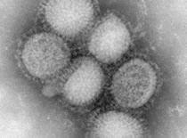 H1N1 Flu QUESTIONS & ANSWERS Novel H1N1 Flu (Swine Flu) and You June 30, 2009 4:00 PM ET Novel H1N1 Flu What is novel H1N1 (swine flu)?