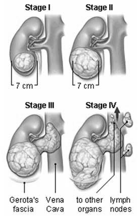 Dialysis Hemodialyis http://www.youtube.com/watch?v=e8uj-c1-hyu htt://dpc.convio.net/media/dialysis.htmlp Vascular access management http://www.youtube.com/watch?v=miw_wm2d8h4 Peritoneal part 1 http://www.