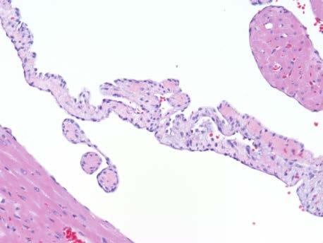 microscopy of myocardium