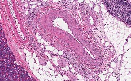 7%) Multifocal myocardial necrosis Single dose rat CV study Arterial injury in the mesentery Minoxidil (mg/kg) MAP HR 3 Maximal decrease of 22 mmhg Effect last ~22 h Maximal increase of 70