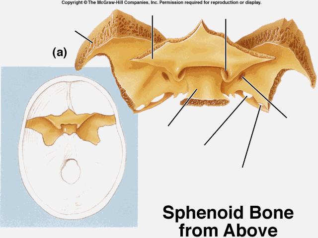 5. Sphenoid butterfly
