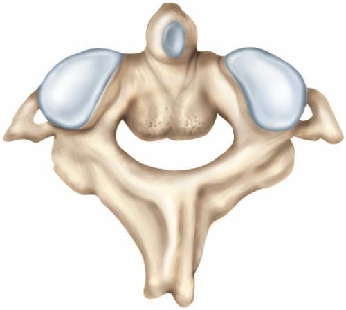The Cervical Vertebrae Dens (odontoid process) Superior articular facet Transverse foramen Transverse process Inferior articular process Lamina Spinous process (b) Axis Figure 8.