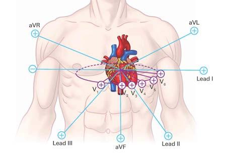 TL CardioPoint ST Maps 2 Introduction Since the ST-segment analysis gives highly valuable information about a patient s heart condition, it is a matter of high