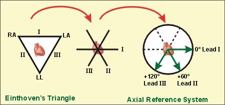 avr: right arm, avl: left arm, avf: left leg I, II, avl: Left lateral surface.