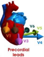 between V2 and V4 Left Precordial leads V4: left 5 th intercostal