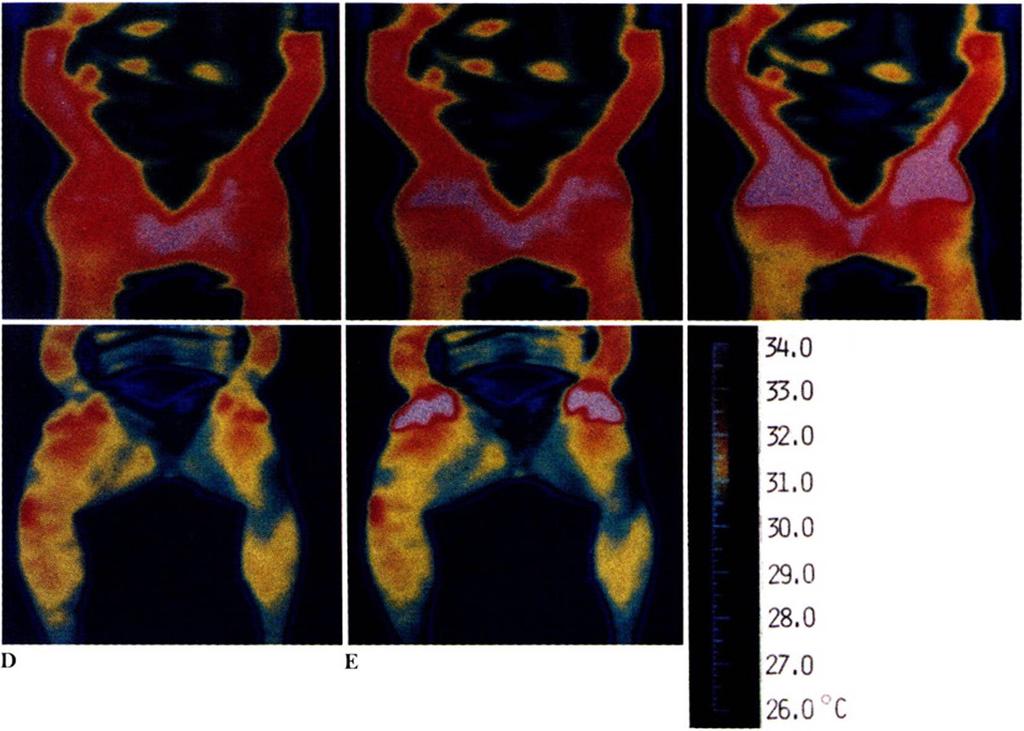 Thermography of a beginner at the end of the control period