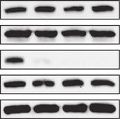 NF-kB activation. Western blot of phospho-p65 serine 536 from SKBr3 (a), H16N2-Her2 (b) and MDA-MB-453 (c) cells treated with PI3K-inhibitor inhibitor LY2942 for 2 h.