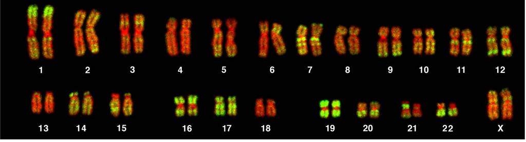 Karyotype (picture of chromosomes in a cell) Human Karyotype In diploid organisms,