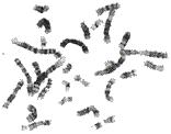 In this activity, you will use a computer model to look at chromosomes and prepare a karyotype.
