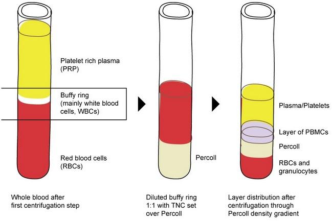 Immunophenotyping Peripheral blood mononuclear cells (PBMC) fraction