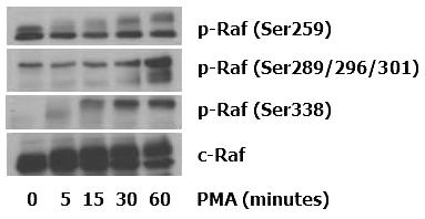 A. B. WT2 Cells V7 Cells (PMA-sensitive phenotype) (PMA-resistant phenotype) C. D. V3 Cells V10 Cells (intermediate phenotype) (intermediate phenotype) Figure 3-1.