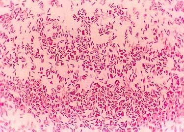 Bacteria: Gram +ve: Staphylococcus aureus has golden yellow hueskin infections, pneumonia, sepsis Gram -ve: Escherichia