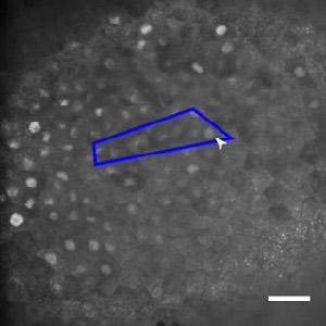 5 H (purple star) is denoted by the blue outline and arrow. Bar, 100 µm. Video 6.