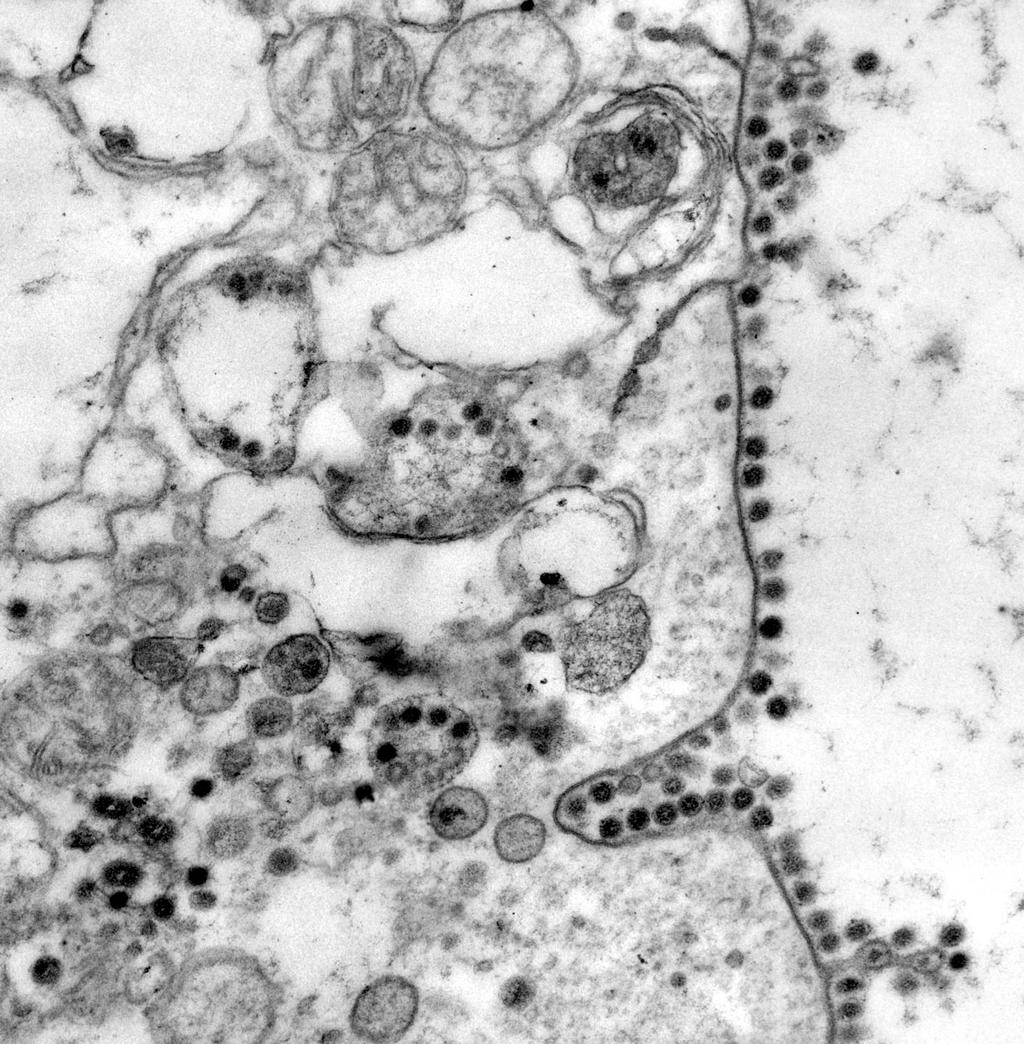 Coronavirus (~70-200nm) Coronavirus on a Mouse epithelial cell