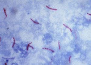 Mycobacterium Characteristics - Large, very weakly gram positive rods - Obligate aerobes, related to Actinomycetes - Catalase positive - Non spore forming - Non motile - very slow growing- slow