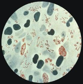 Mycobacterium leprae - Gram positive - Acid fast bacilli - Causes leprosy - non motile - aerobic - Mostly found in warm tropical countries - Obligate intracellular parasite- Cannot be cultivated