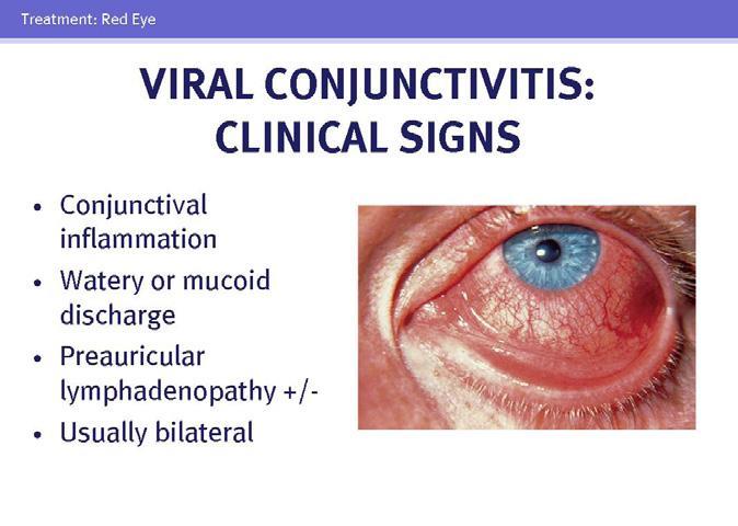 Although conjunctivitis is typically benign and self-limited, it can be confused with the other three conditions, all of which require prompt diagnosis and appropriate treatment and referral.