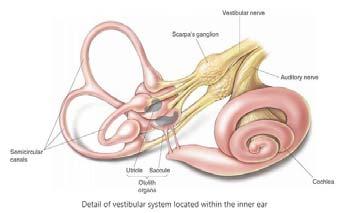 of: Superior Canal Dehiscence (SCD) Meniere s Disease Acoustic Neuroma/Vestibular Schwanomas Multiple sclerosis (MS) Otosclerosis Idiopathic sudden hearing loss with vertigo Bilateral vestibular loss