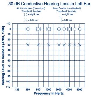 between 250 and 8000 hertz (Hz) for pure tones and measured in decibels (db). The 0 db level is "normalized" to young, healthy adults and doesn't mean there is absence of detectable sound.